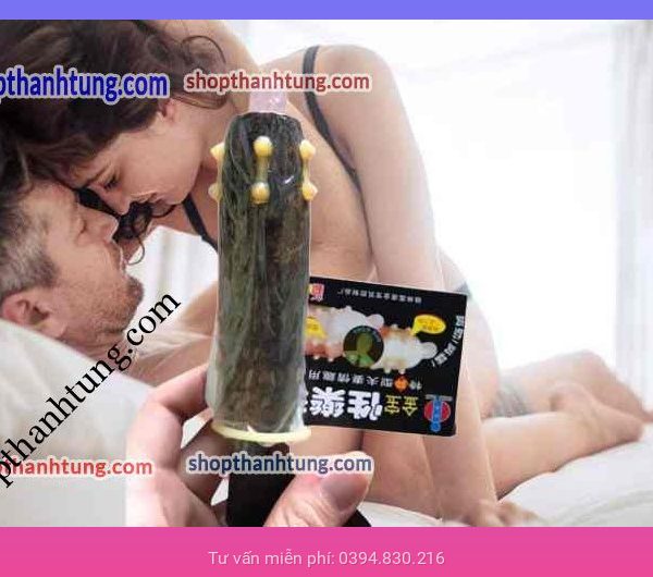 BAO CAO SU GOLD BI HẢI PHÒNG