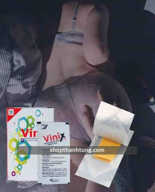 Địa chỉ bán tem vinix tại Bến Tre