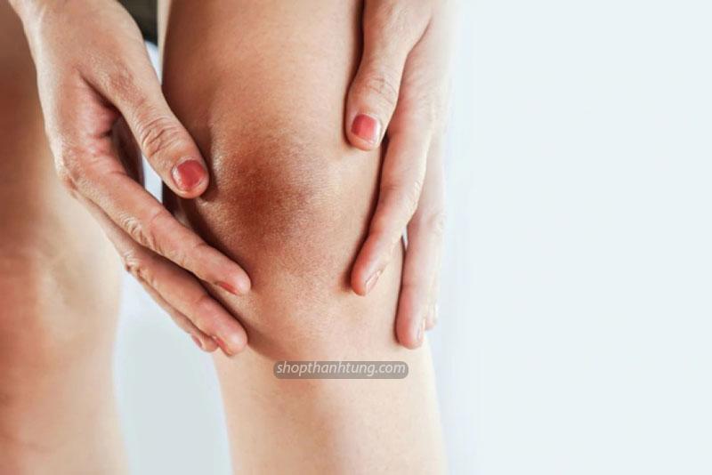 Đầu gối thâm có nguy hiểm không