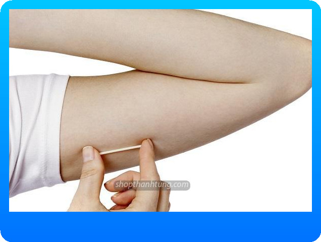 Cấy Que Tránh Thai Và Những Điều Cần Biết