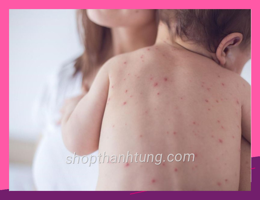 Minh họa cho lam sao de khong bi lay thuy dau với góc nhìn tự nhiên