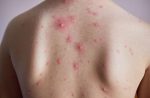 Ảnh thực tế benh thuy dau co bi vo sinh khong với bố cục hài hòa