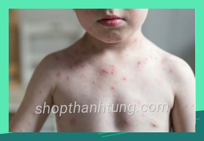 Mẫu thuy dau lay qua duong nao 600x400 có tính thẩm mỹ cao
