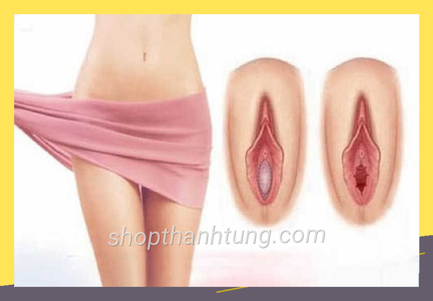 Va mang trinh